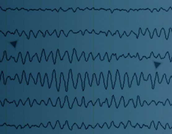 electroencefalografia